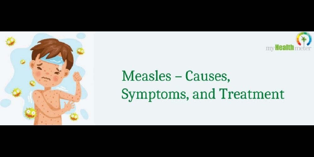 Measles – Causes, Symptoms, and Treatment