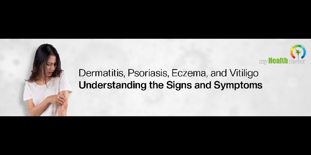 Dermatitis, Psoriasis, Eczema, and Vitiligo Understanding the Signs and Symptoms