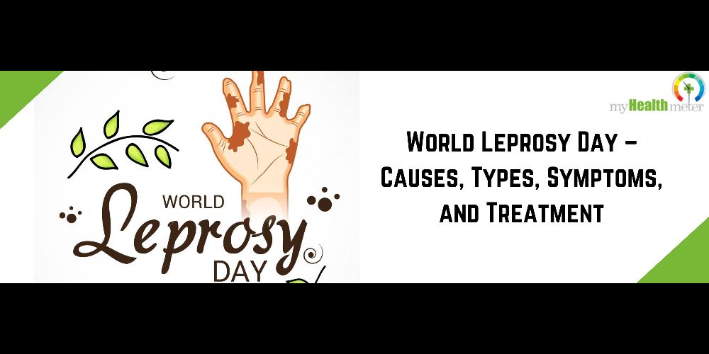 World Leprosy Day – Causes, Types, Symptoms, and Treatment