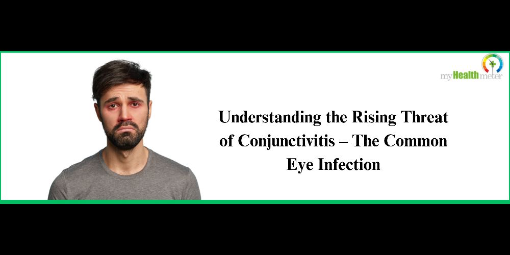 Understanding the Rising Threat of Conjunctivitis – The Common Eye Infection