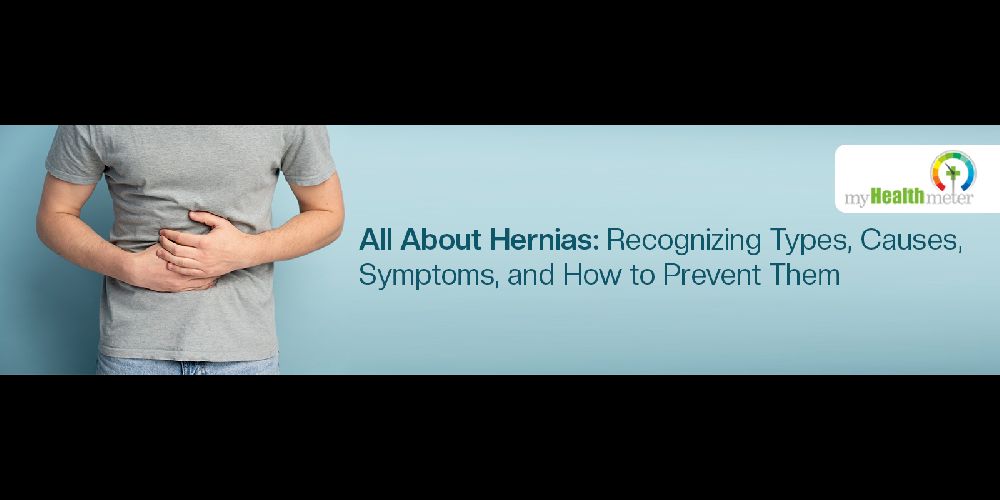 All About Hernias Recognizing Types, Causes, Symptoms, and How to Prevent Them