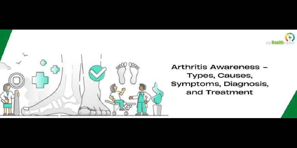 Arthritis Awareness Types, Causes, Symptoms, Diagnosis, and Treatment