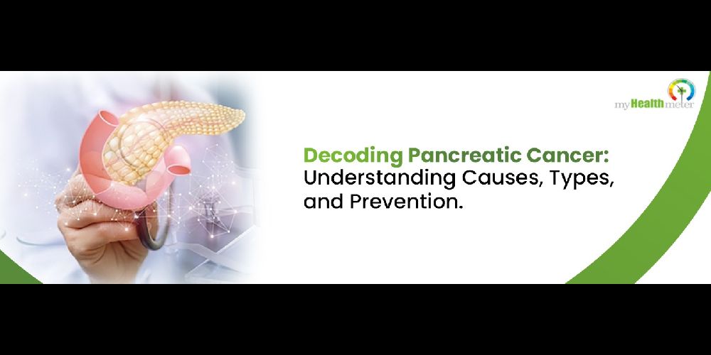 Decoding Pancreatic Cancer: Understanding Causes, Types and Prevention.
