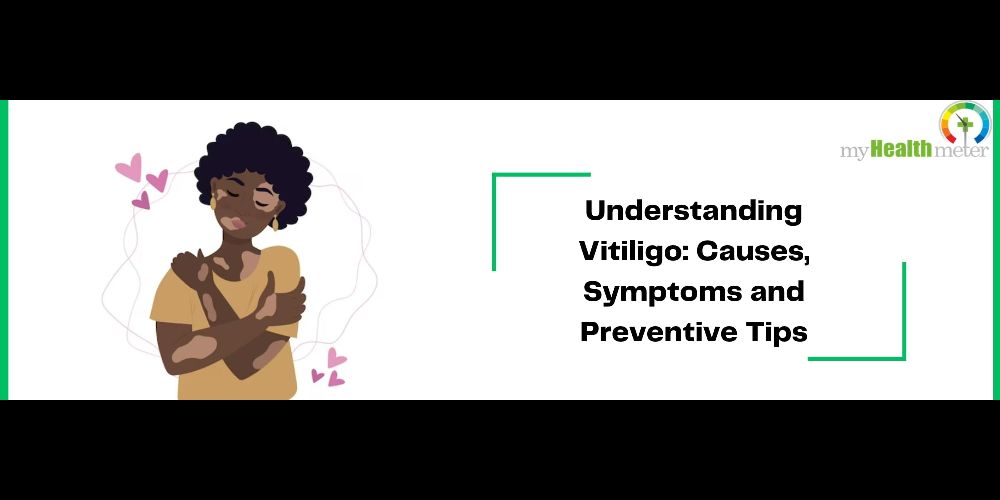 Understanding Vitiligo: Causes, Symptoms and Preventive Tips