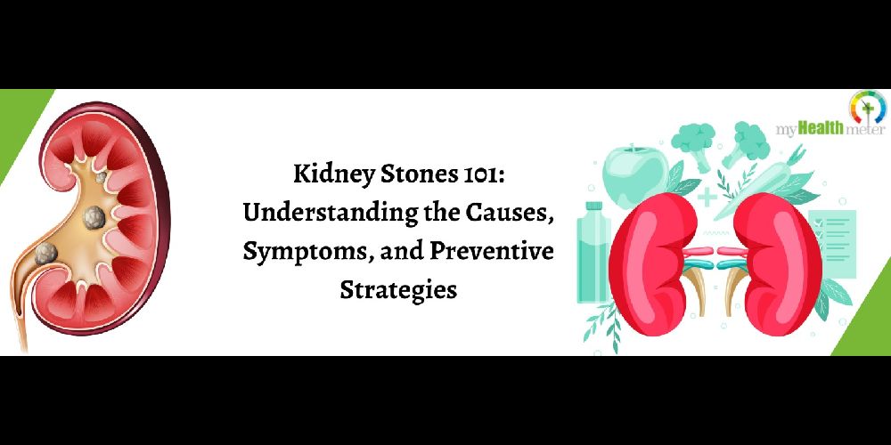 Kidney Stones 101: Understanding the Causes, Symptoms, and Preventive Strategies