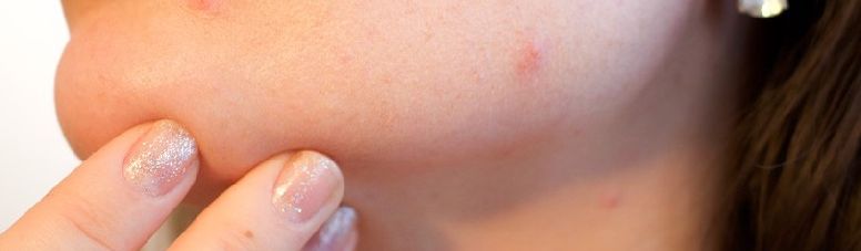 Adverse impact of not moisturising your skin